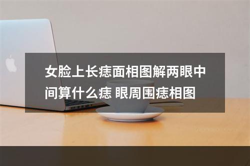 女脸上长痣面相图解两眼中间算什么痣 眼周围痣相图
