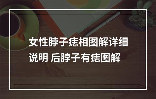 女性脖子痣相图解详细说明 后脖子有痣图解