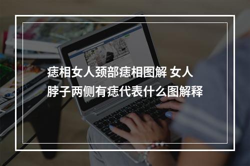 痣相女人颈部痣相图解 女人脖子两侧有痣代表什么图解释