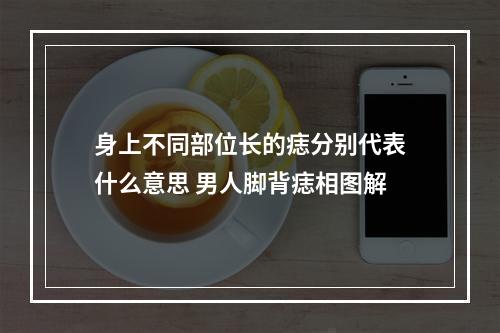 身上不同部位长的痣分别代表什么意思 男人脚背痣相图解