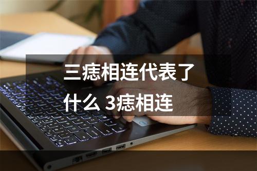 三痣相连代表了什么 3痣相连