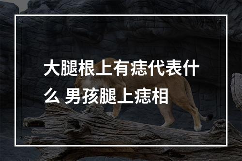 大腿根上有痣代表什么 男孩腿上痣相